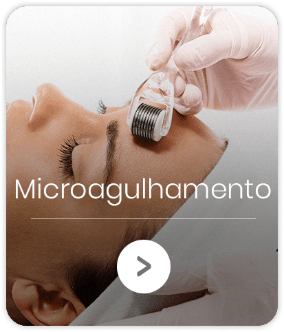 microagulhamento-home